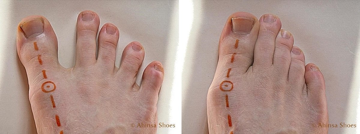 aligned-toes